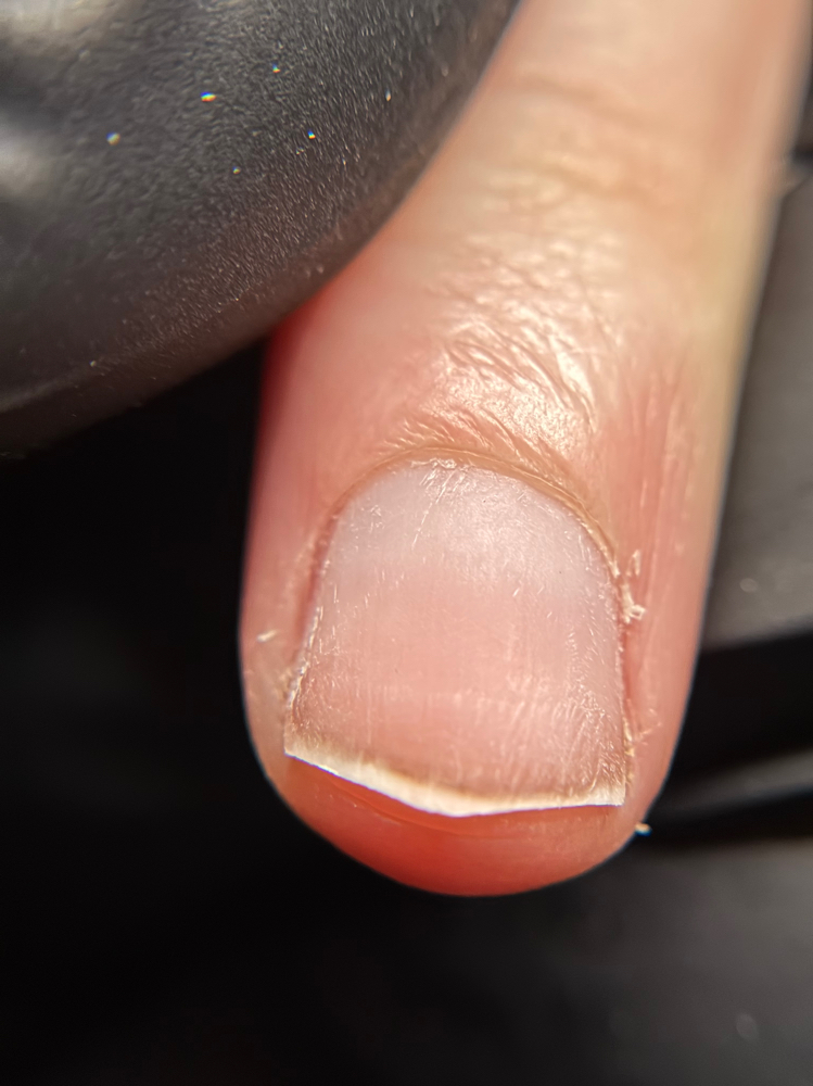 Dry Mani