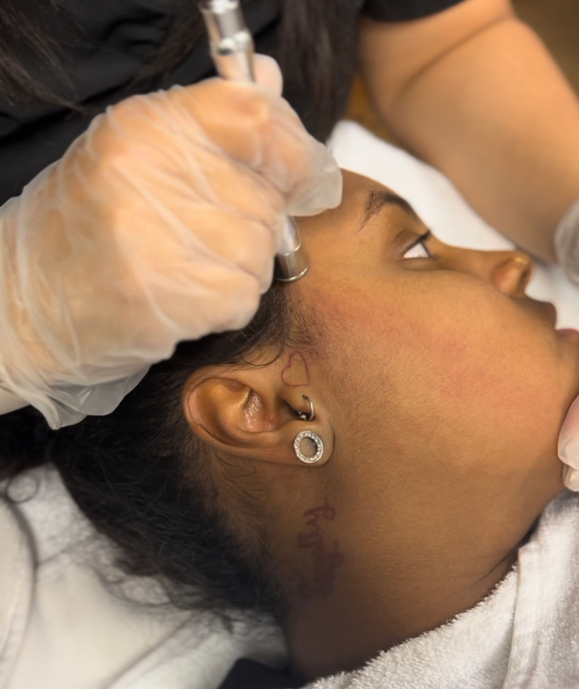 Microderm Facial