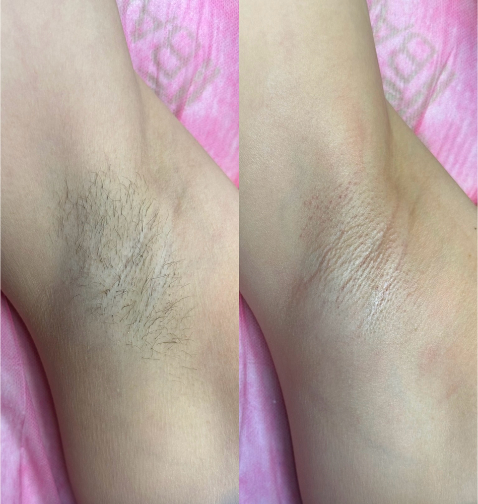 Underarm Wax