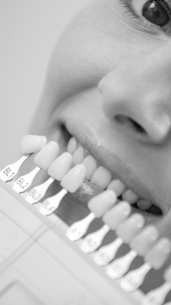 Teeth Whitening