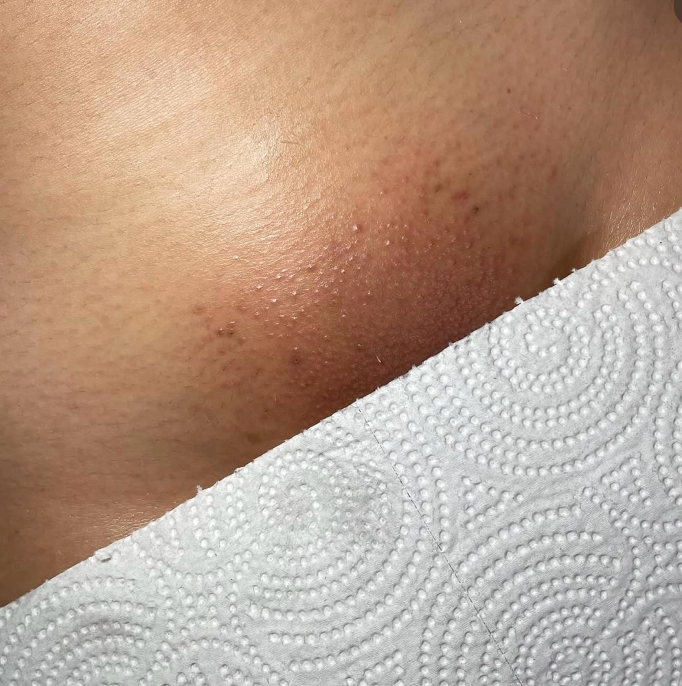 Brazilian Wax