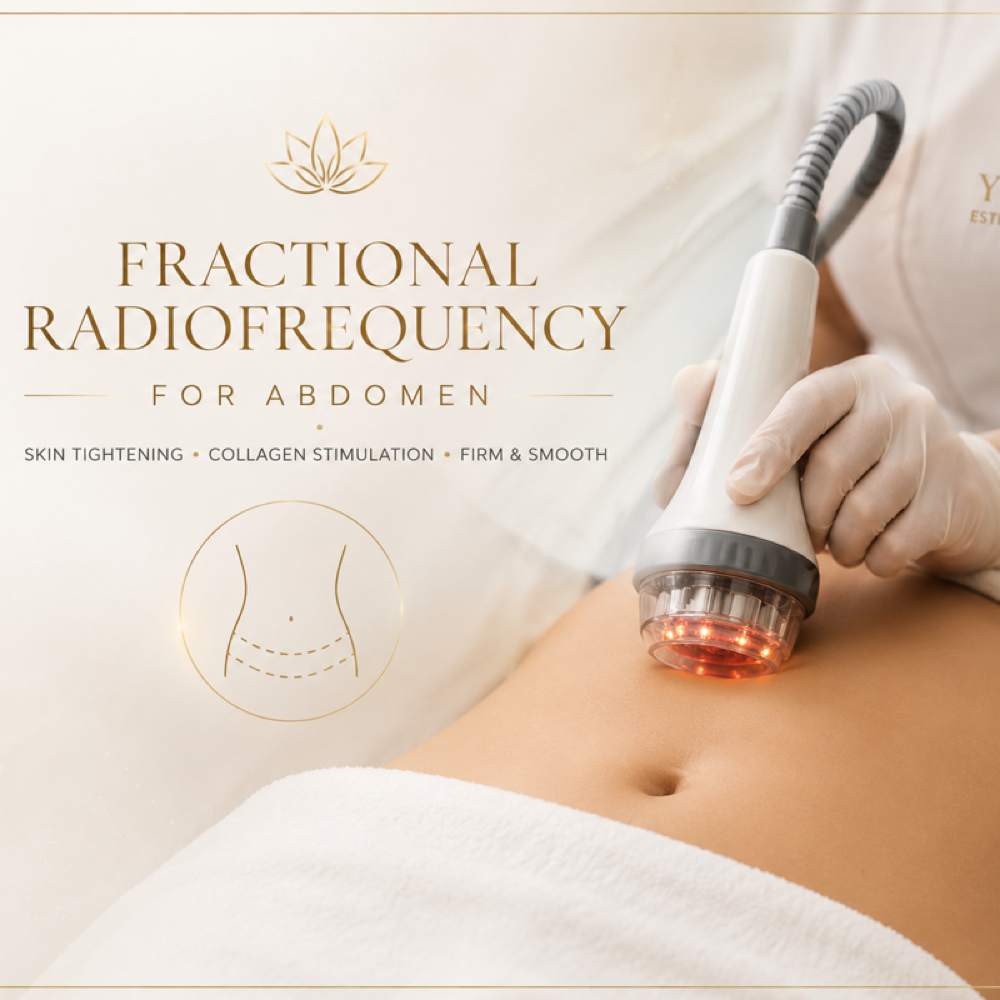Abdominal Skin Renewal RF at Yoanny Beauty Spa in Schaumburg IL, IL