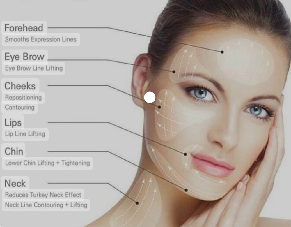 Thread Lift facial
