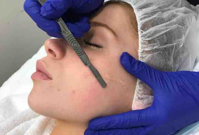 Dermaplane with an Enzyme And LED