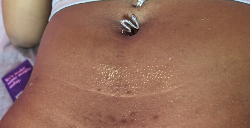 Belly strip wax
