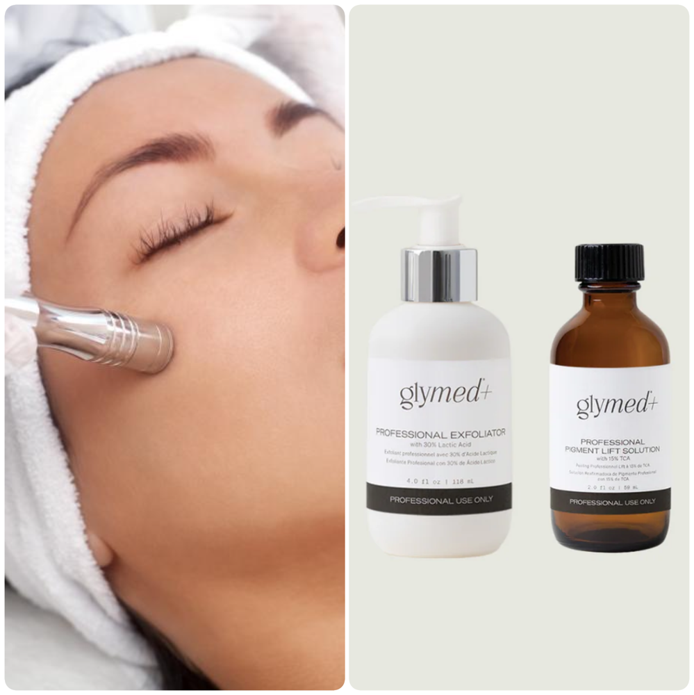 Microdermabrasion and Chemical Peel