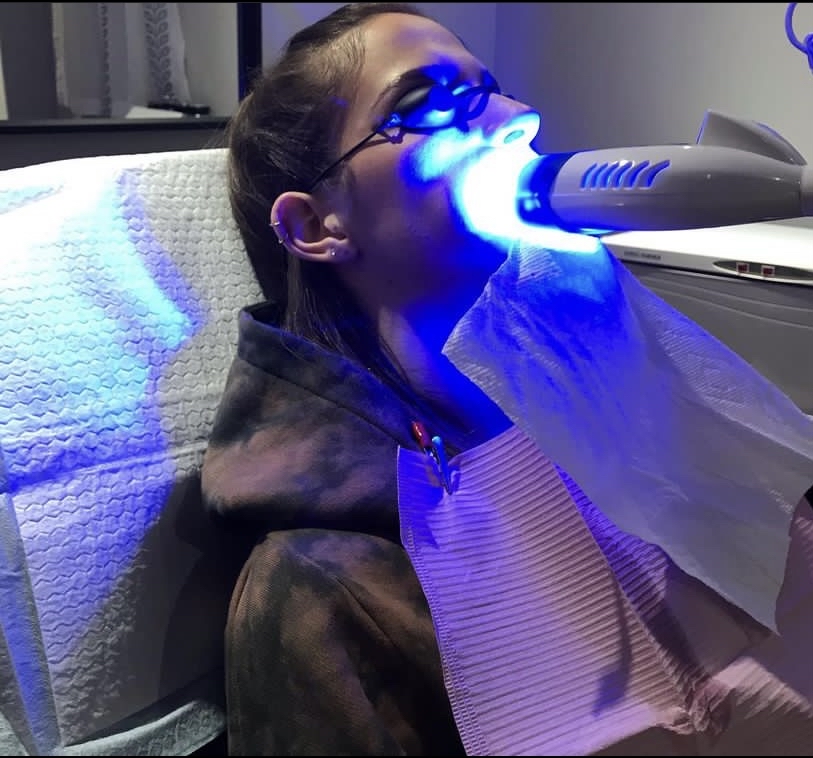 Teeth Whitening