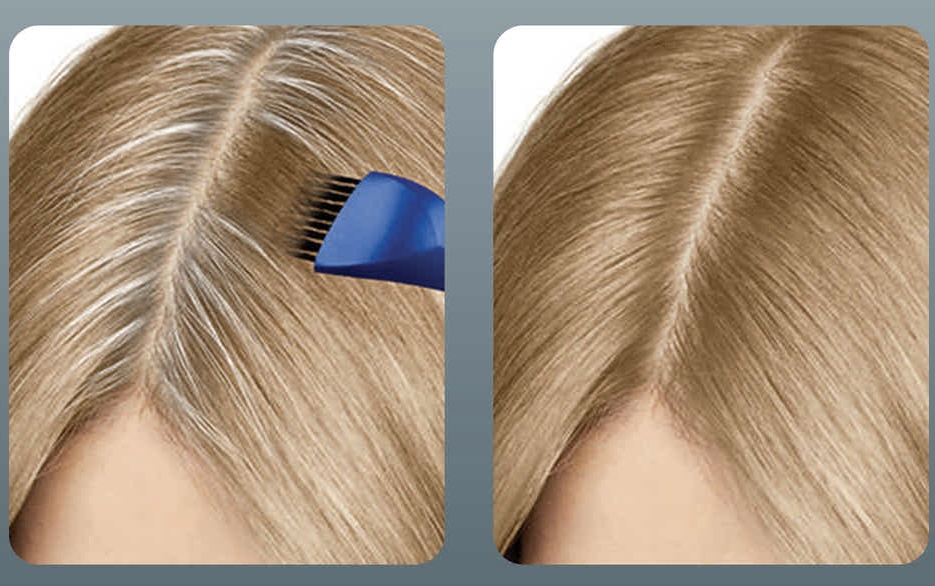 Partial Root Touch Up