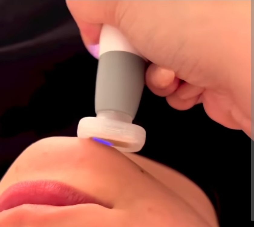 SKIN REJUVENATION