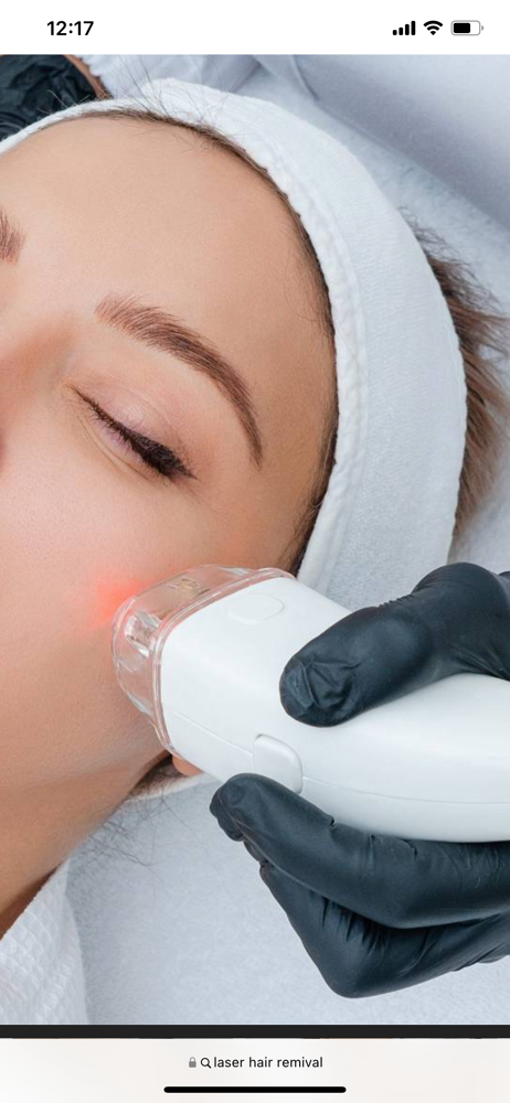 Laser Hair Removal