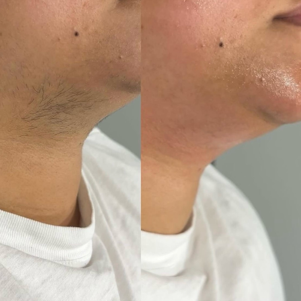 Chin Wax at True Beauty LLC in Hobart, IN