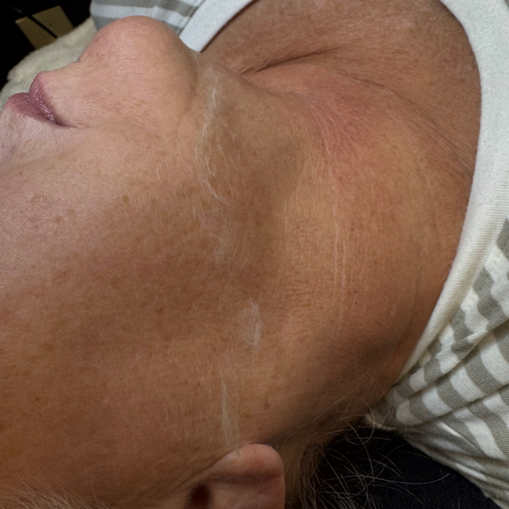 Dermaplaning at Grace & Glow Skin Studio in Mt. Orab, OH
