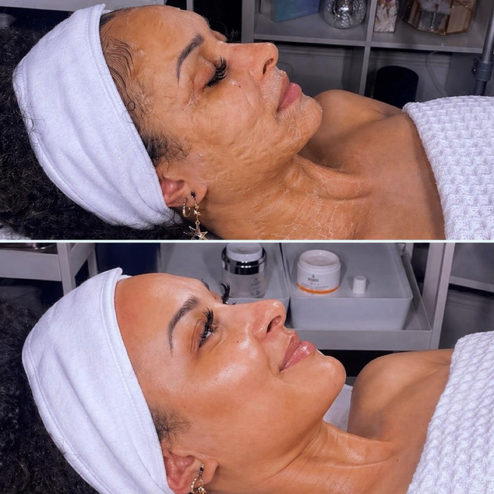 Ageless Smooth Facial at Meticulous Spa and Beauty in New Haven, CT