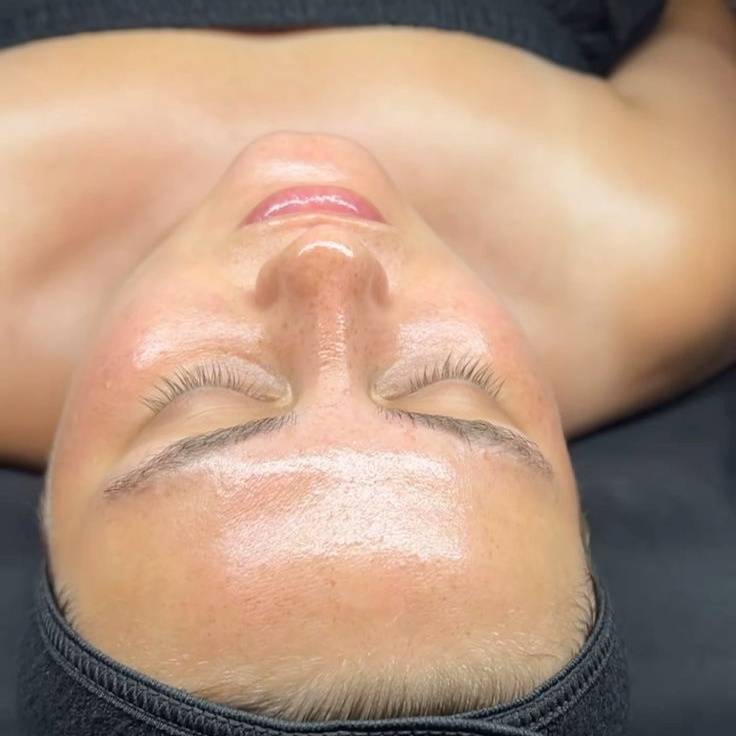 The Deep Clarifying Peel at Jennifer Marie Skincare in Elkhart, IN