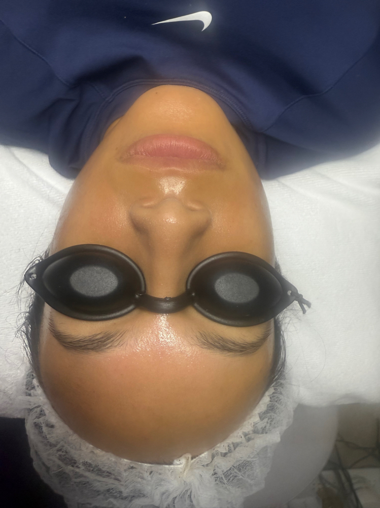 Post Op Treatment For Chin (5)