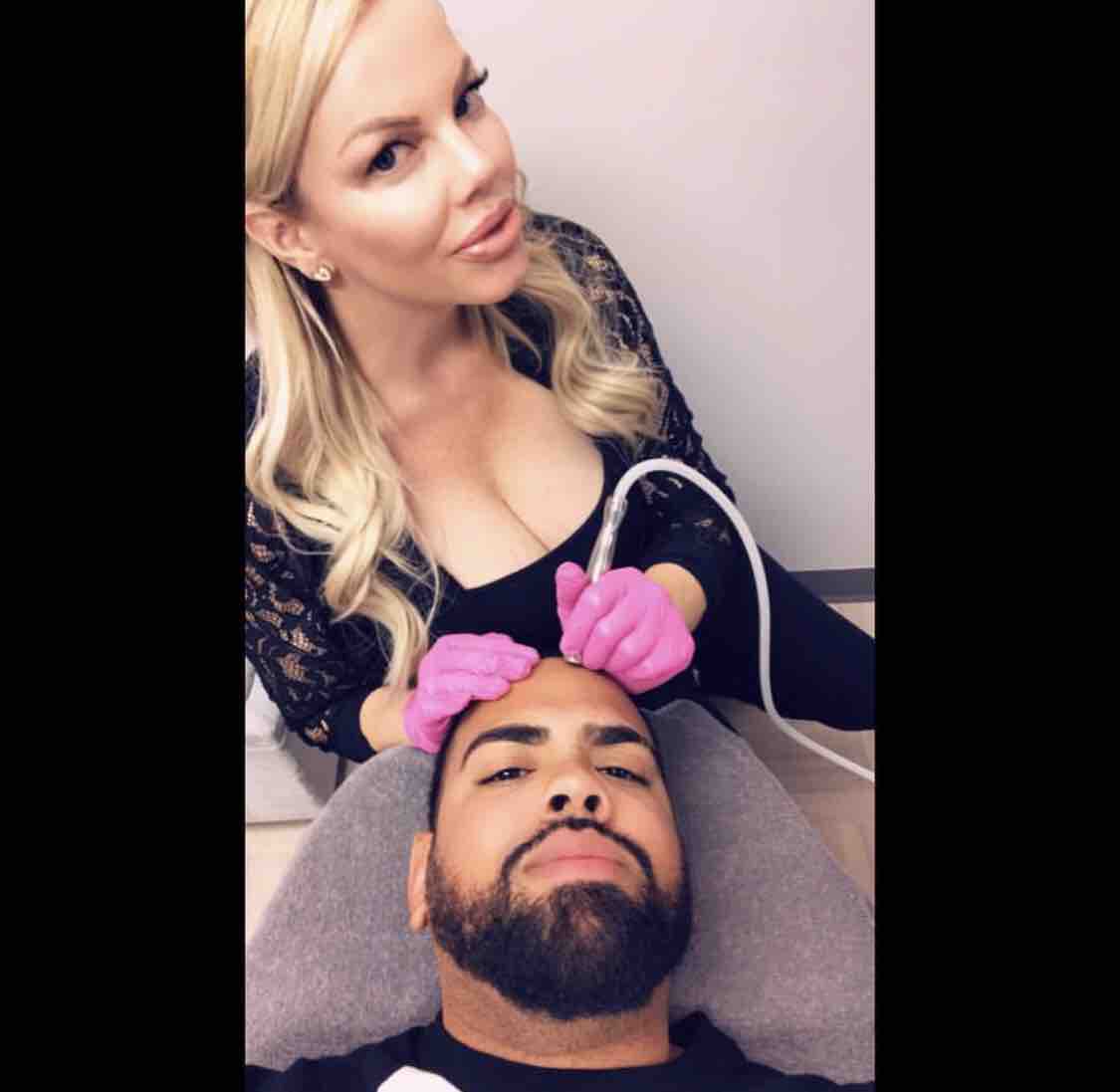 Microdermabrasion
