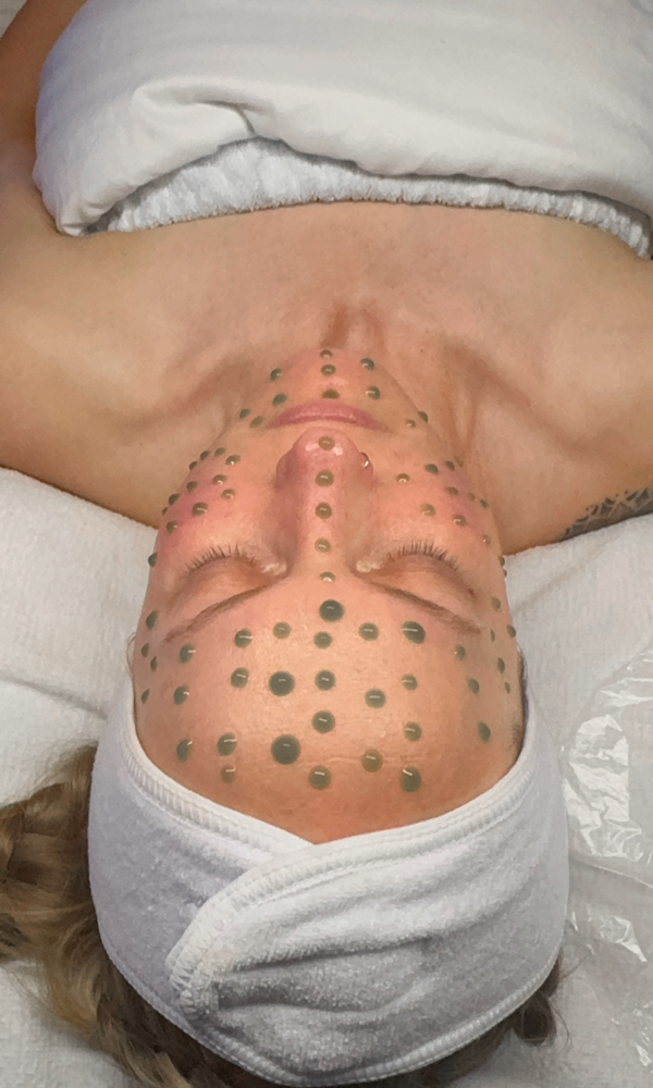 Inflacure Healing Recovery Tx