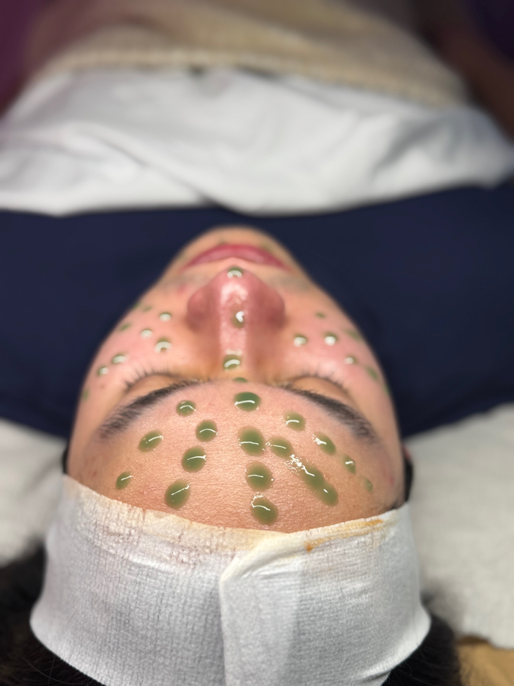 Inflacure Healing Recovery Tx