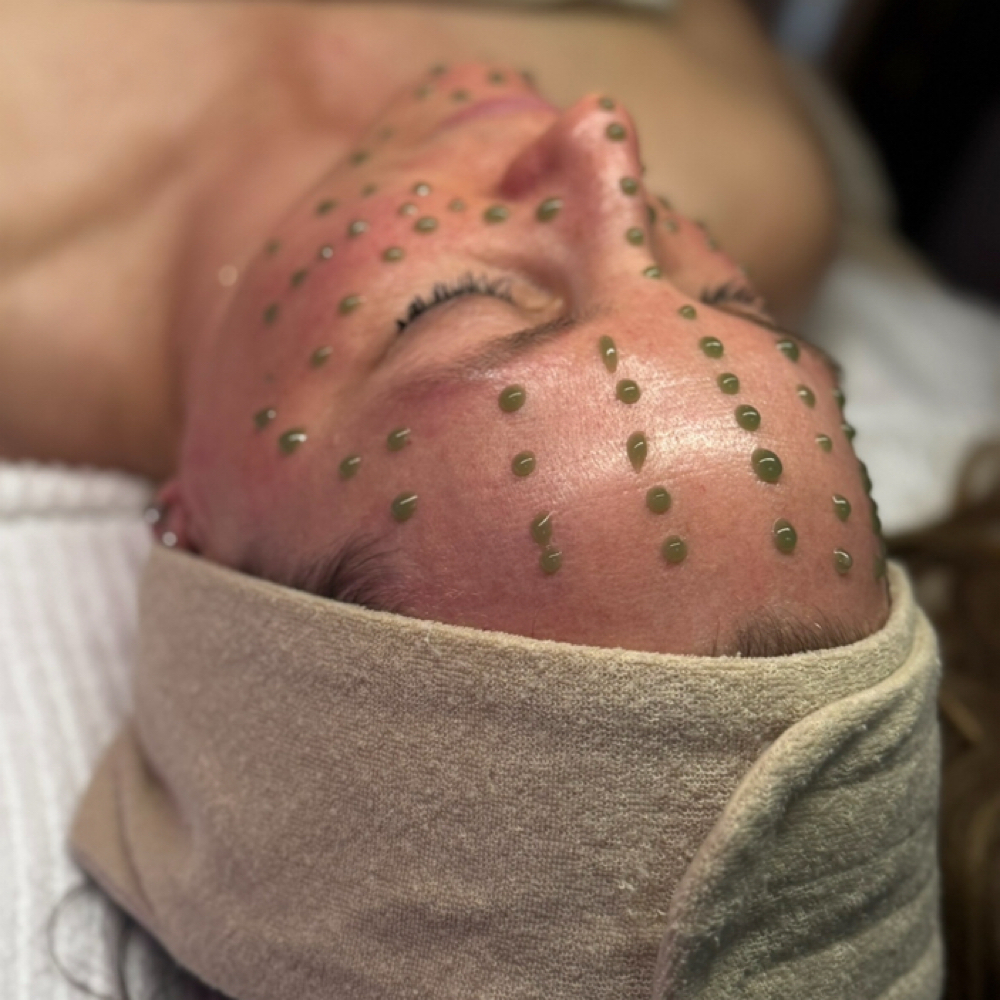Inflacure Healing Recovery Tx at Glow with Lindsay Esthetics in Rodeo, CA