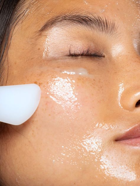 Chemical Peel