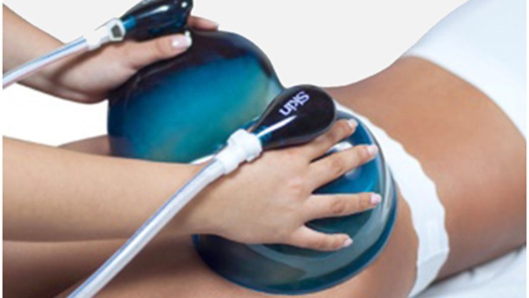 Butt Cupping + Wood Therapy