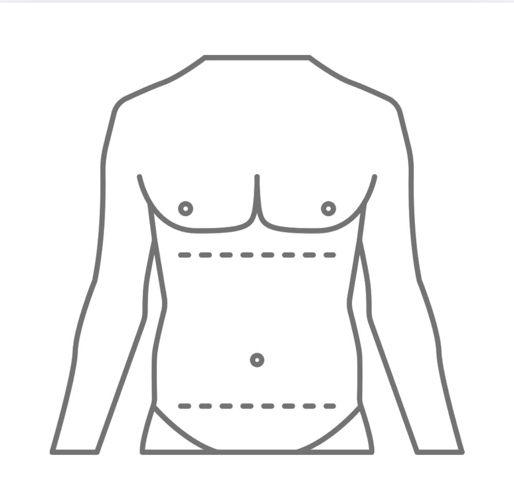 Full Abdomen LHR at SkinFix Laser Hair Removal in Richland, WA