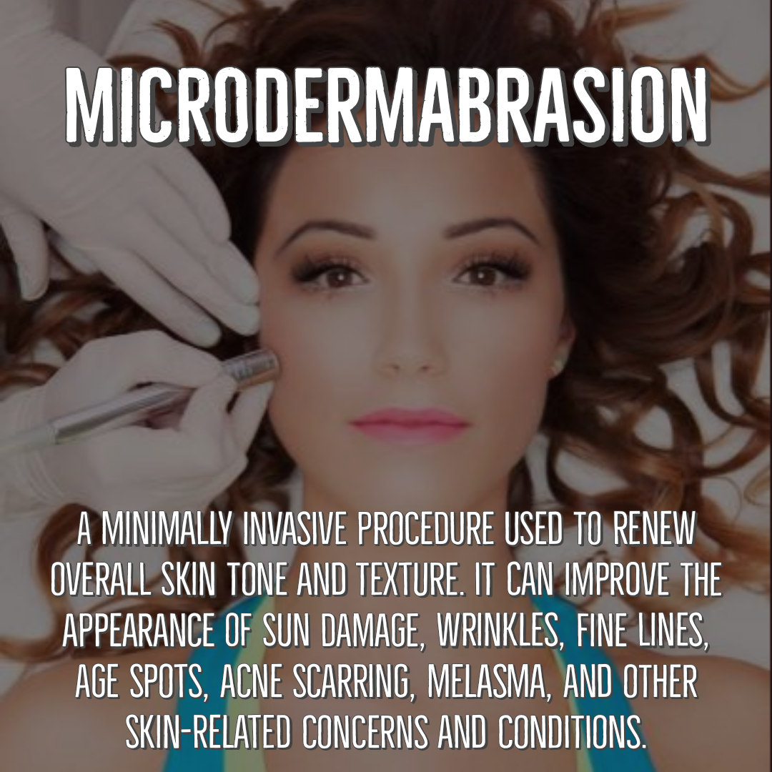Microdermabrasion Facial w/LED