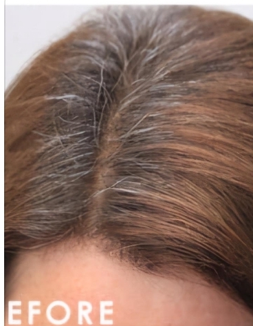 Regrowth Color Only