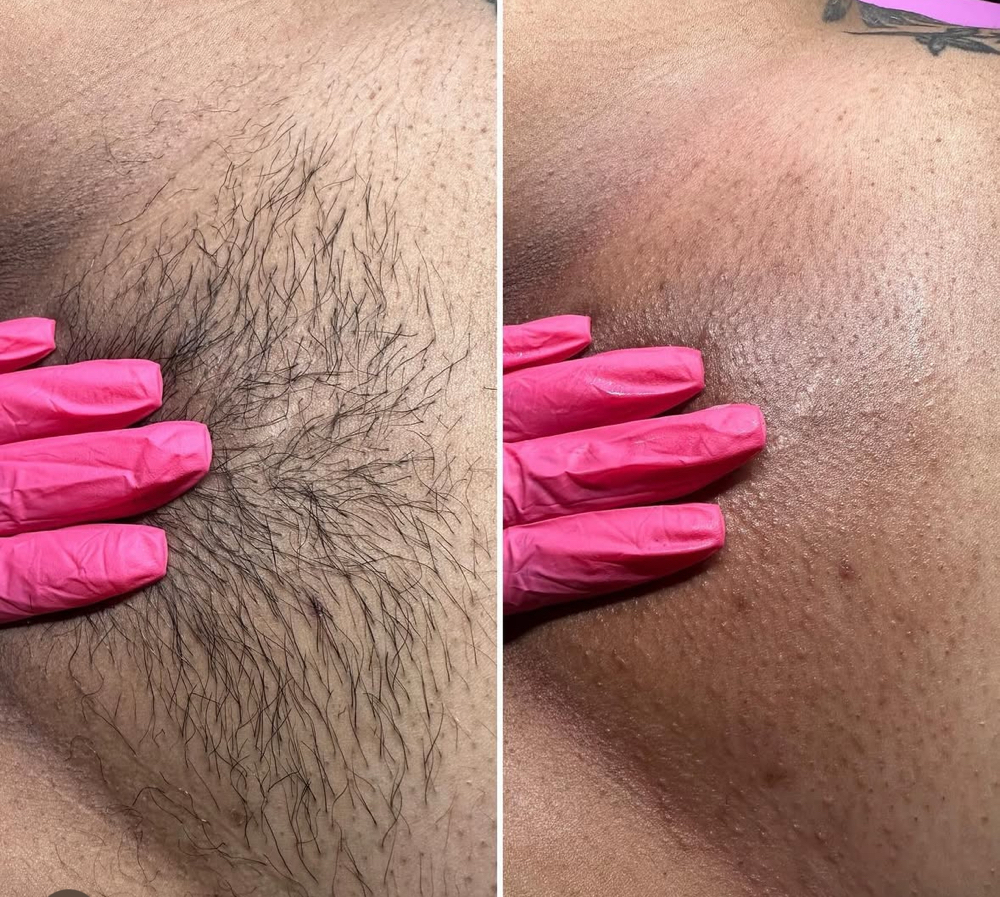 Brazilian Wax