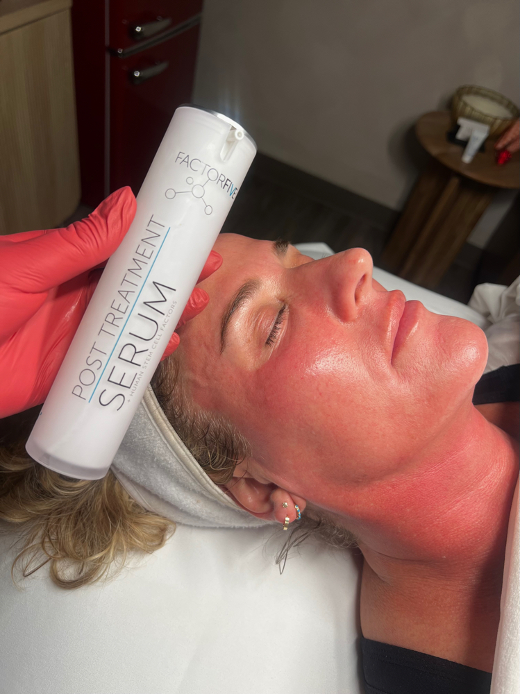 MAY SKINPEN SPECIAL