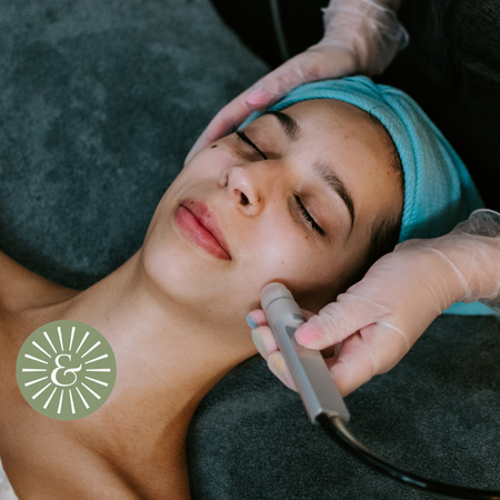 Microdermabrasion & Glow