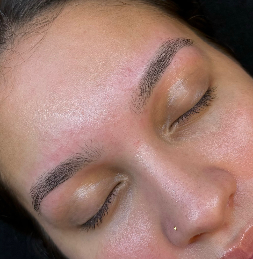 Brow, Lip, OR Chin