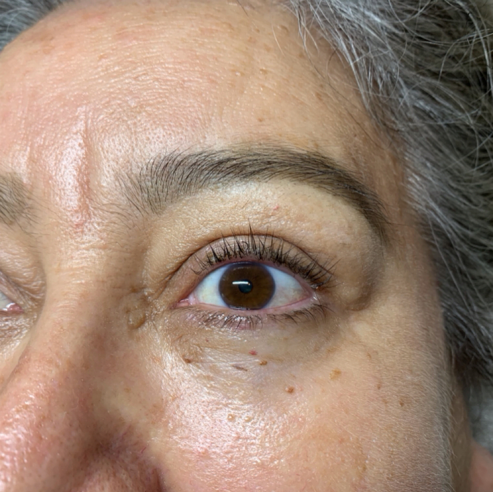 Lash Lift & Tint at The Skin Room Aesthetic and Wellness LLC in Longview, TX