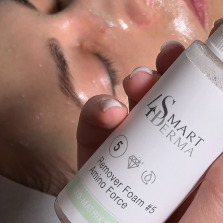 TREATMENT with " SMART4DERMA " at Flamingo Spa Inc in Wheeling, IL