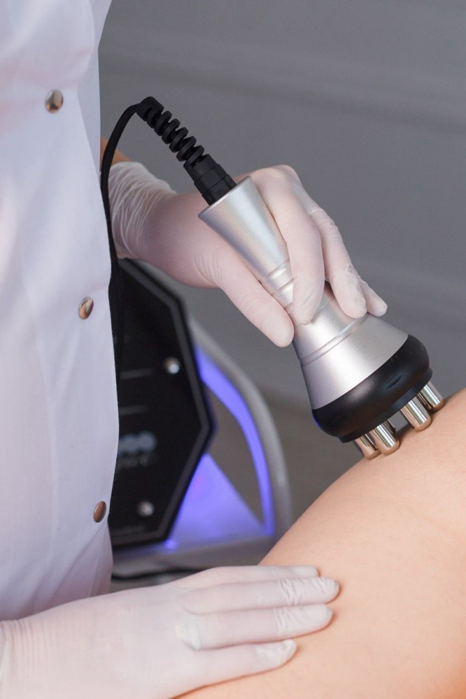 RF Skin Tightening