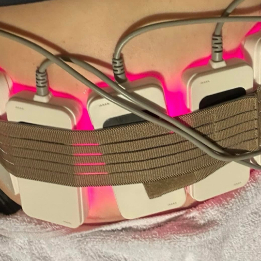 Laser Lipo at Silhouette Body Sculpting LLC in St. Peter’s, MO
