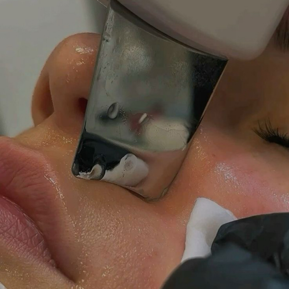 Skin Reset Ritual at Raesthetics LLC in Fort Morgan, CO