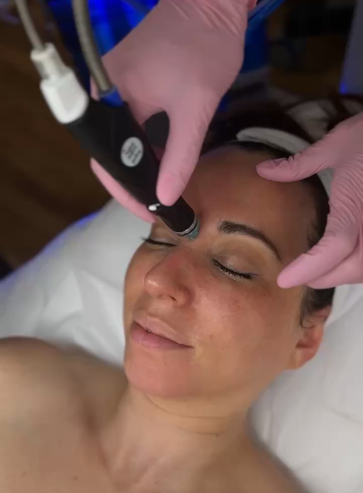 Signature Hydrafacial