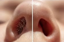 Nose Wax at Bella Donna Esthetics in Beaufort, SC