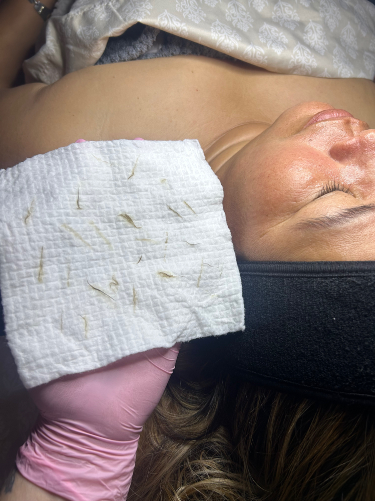 Dermaplaning Facial
