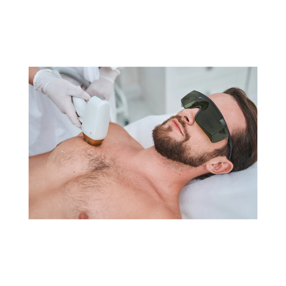 Laser Removal - Chest (6 Sessions)