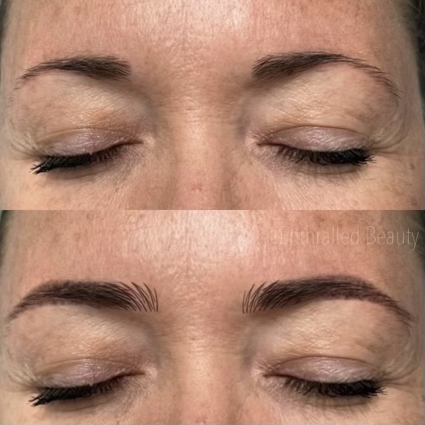 Virtual Brow Consultation