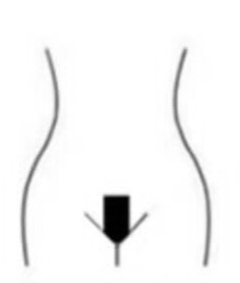 Deep Bikini Sugaring