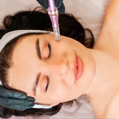 Collagen Induction Therapy at Bloom Esthetics by Ellie in colorado springs, CO