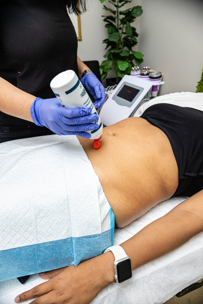 Cavitation, Radio Frequency, Lipo