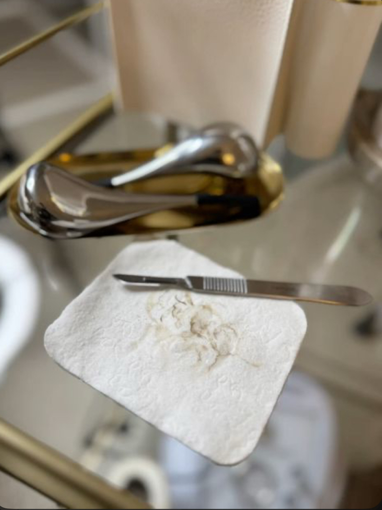 Dermaplane Facial