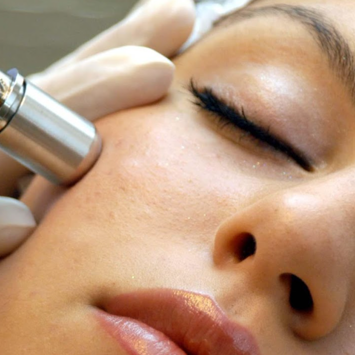 Diamond Microdermabrasion at Empower Aesthetics in Canyon Lake, TX