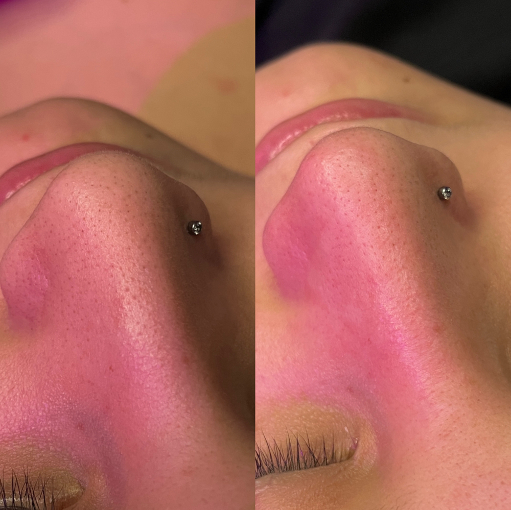 DREAM GLOW-Corrective Custom Facial