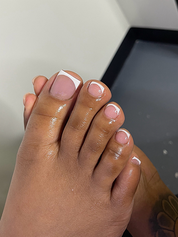 Overlay On Big Toe w/ Pedicure