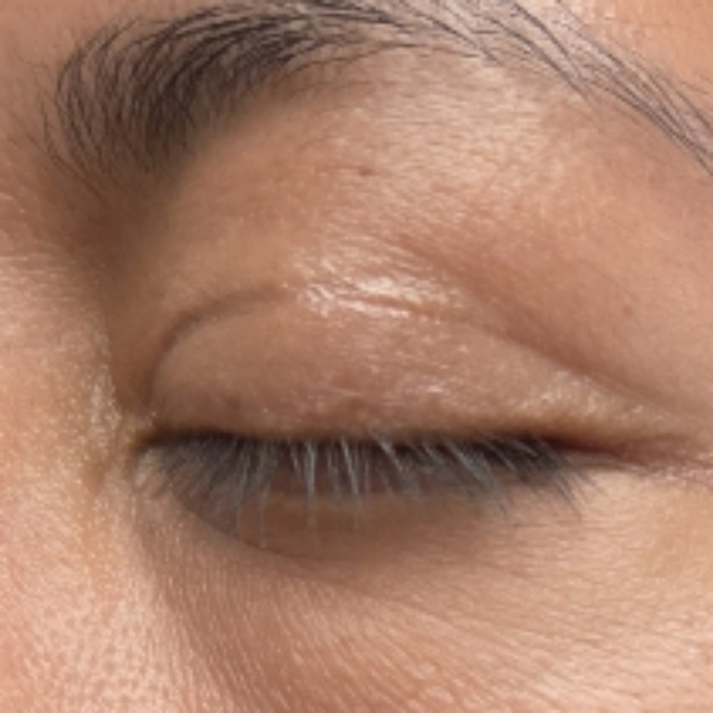 Eye Lids,Lash Line Pro Cleansing at The San Antonio Esthetician in San Antonio, TX